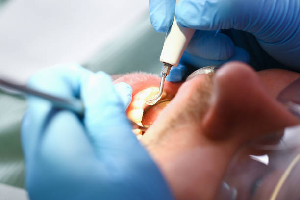 Best Emergency Treatment for Oral Infections in Tifton, GA