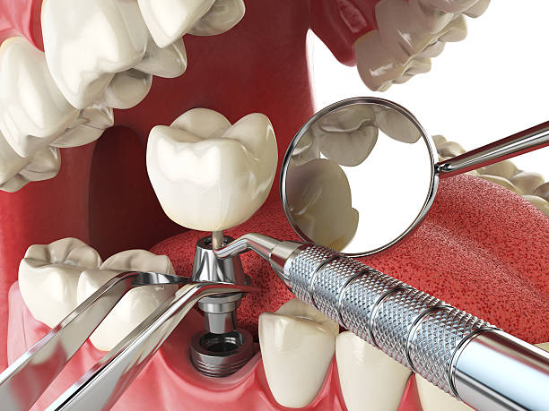 Best Emergency Care for Gum Disease in Tifton, GA